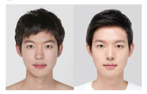 打美白针多少钱一疗程 打美白针一般多少钱 美白针一疗程多少钱