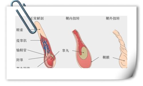 蛋蛋皮痒怎么回事 右侧蛋蛋疼怎么回事啊？