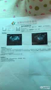 宫外孕 打胎多少钱 宫外孕打胎多少钱 宫外孕术后下一胎会否还是宫外孕