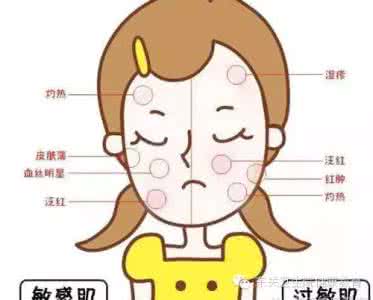 换季皮肤过敏的症状 换季皮肤过敏的症状 秋老虎驾到 换季请先防过敏