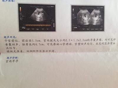 孕囊扁 孕囊扁长是怎么回事?可能是用药不当引起的