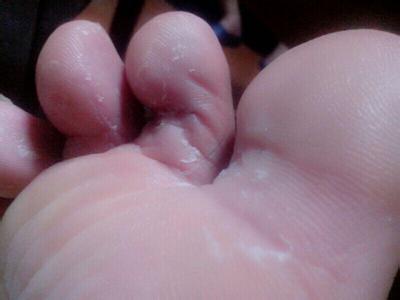 儿童皮肤瘙痒用什么药 芽儿很痒用什么药？