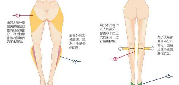 瘦小腿最有效的方法 瘦小腿的方法 瘦小腿最快最有效的四个方法