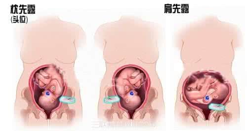 什么时候测胎心最好 在家怎样用胎心仪测胎心