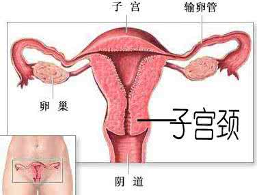 宫颈息肉的危害 宫颈息肉是怎么引起的 宫颈息肉的危害有哪些