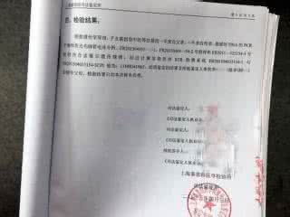 最简单的亲子鉴定方法 做亲子鉴定的简单方法有哪些