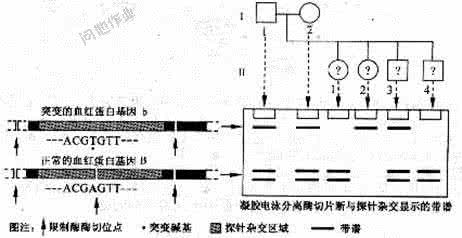 单基因遗传病 核酸杂交 单基因遗传病可以通过核酸分子杂交技术进行早期诊断。镰刀型细胞贫血症是一种在地中海地区发病率较高的单基