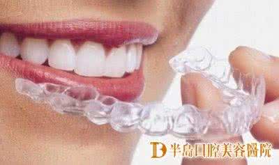 口腔医院牙齿矫正费用 口腔医院牙齿矫正费用 口腔牙齿矫正后怎么护理