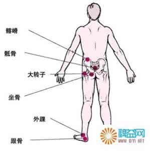 褥疮烂到什么程度会死 白芨粉外敷治愈烂腿褥疮龟头炎