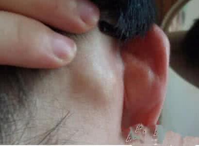 婴儿感染艾滋病的症状 感染艾滋病的症状 细数艾滋病十大常见症状