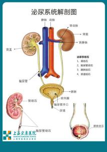 肾结石多喝水有用吗 肾结石多喝水有用吗 多喝水,会喝水,常运动 不让肾结石“有机可乘”