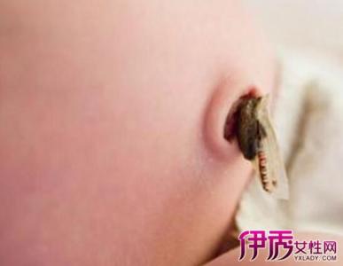 婴儿脐带脱落后有脓 婴儿脐带脱落后有脓 脐带脱落后有脓怎么办？