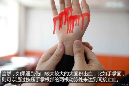 学会救命心肺复苏术 学会这动作竟然能够救命