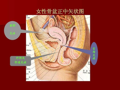 慢性盆腔炎的临床表现 急性与慢性盆腔炎临床表现