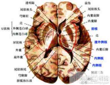 高血压脑出血常见部位 高血压脑出血常见部位 高血压脑出血最常见的部位是哪里？