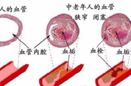 郭力话健康 郭力话健康：舌苔，健康烽火台