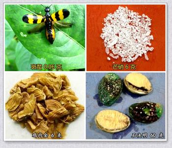 胆结石和膀胱结石 胆结石、肾结石·膀胱结石：一剂即可排出