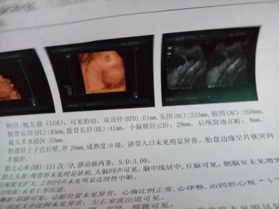 胎儿多大有心跳 胎儿多大有心跳及检测方法