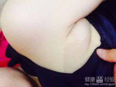 剖腹产后副乳怎么消除 如何消除产后副乳