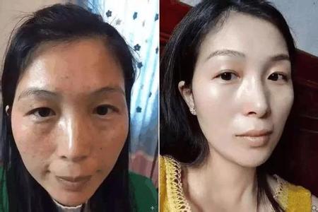 红糖加一宝 红糖加一“物”, 一夜斑点消逝, 37岁大姐脸蛋水嫩年轻近10岁