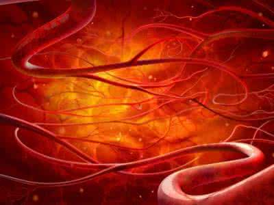 血管硬化吃什么食物 什么食物能让你硬化的血管柔软起来？