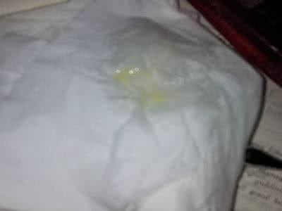 排卵期白带多 排卵期白带多 排卵受精为何白带会多？