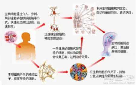 肌肉痉挛产生的原因 痉挛产生的原因 痉挛产生的六大原因