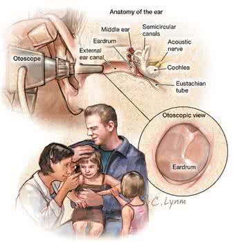 jama pediatrics jama pediatrics Jama Pediatrics丨孕期流感病毒A(H1N1)疫苗暴露与儿童早期患病率的关系