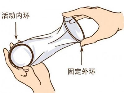 最舒服又安全避孕方法 什么是避孕