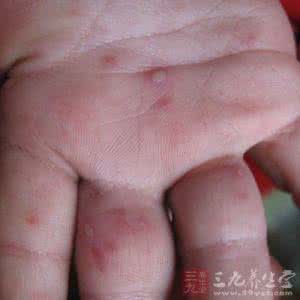 牛腹泻性疾病病因分析 接来了腹泻 吻出了疾病