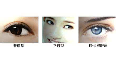 做上睑下垂矫正术 上睑下垂手术 上睑下垂矫正术