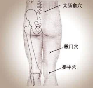 坐骨神经痛的症状 坐骨神经痛 按压穴位调节身体力学