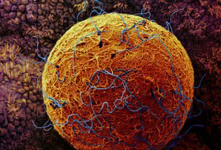 促黄体生成素低吃什么 黄体生成素低要吃什么？