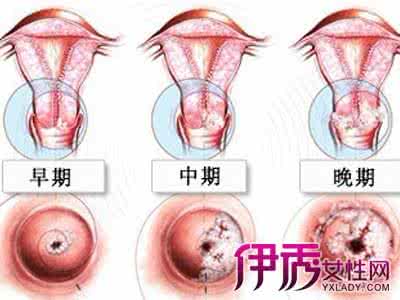 长沙月经不调痛经 一用就灵---痛经、月经不调、大便艰难、黄褐斑、雀斑、黑斑、养颜美容