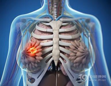 茹贝源专注乳房健康 警惕 毁灭乳房健康的五个“元凶”