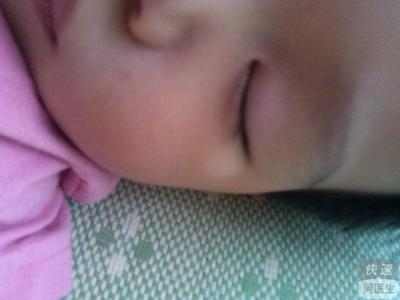 怀孕初期吃什么比较好 白癜风初期怎样治疗比较好