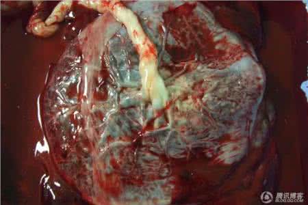 男人吃胎盘有什么功效 男人能吃胎盘吗