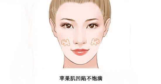 海鲜干货店装修效果图 干货|整形效果不满意,原来是因为这个!