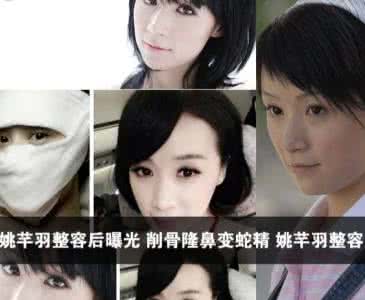 女子花10万整容 女子整容成瘾花30万整十几次