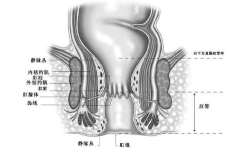 直肠癌肛门会痛吗 直肠癌肛门瘙痒吗？