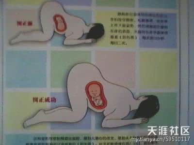 胎位不正该怎么纠正图 胎位不正纠正图 胎位不正应该怎么纠正?