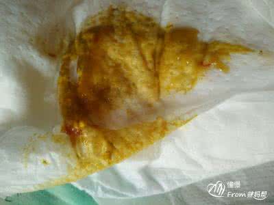 宝宝腹泻便血 腹泻便血 宝宝腹泻便血怎么办？