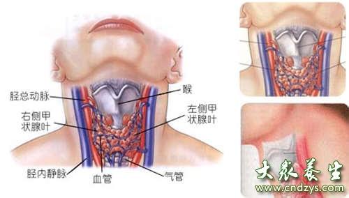 甲状腺炎最好治疗方法 甲状腺炎怎么治疗 甲状腺炎治疗方法哪家好