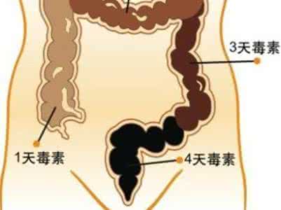 清理肠道宿便最好方法 清理肠道