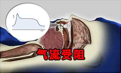 鼾声大是什么原因 打鼾是什么原因引起的