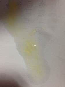射出的精液有块状物 你的精液正常吗？成块状是怎么回事？