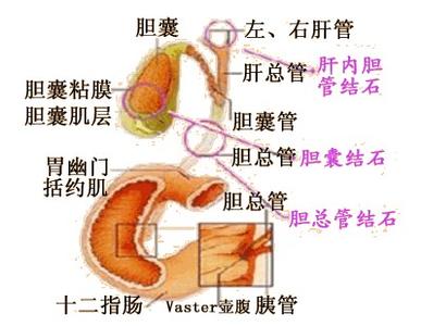 胆结石最佳治疗方法 【转载】引用 能一次治疗所有结石的秘方