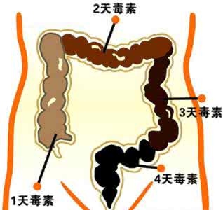 造成肥胖的主要原因 造成肥胖的主要原因 造成肥胖的6大原因