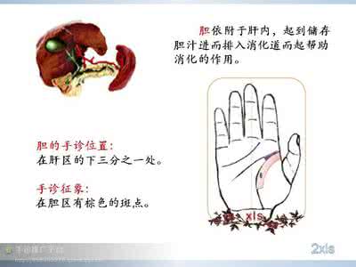胆结石和膀胱结石 图文:肾结石、膀胱结石、胆结石中医推荐处方