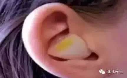 把洋葱放入耳朵一夜 ?? 把洋葱放入耳朵一夜 奇效出现了